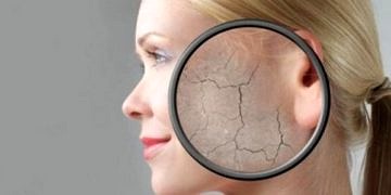 Cilt kuruluğunu önlemek için neler yapmalı?