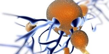 Test aşamasındaki Alzheimer ilacından heyecan veren olumlu sonuçlar geldi