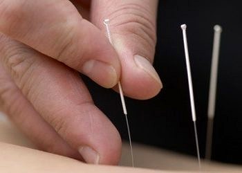 Akupunktur tedavisinin etkili olduğu alanlar