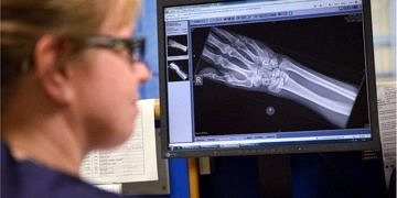 Kemoterapiden yara bandına gereksiz ya da faydası az 40 tedavi