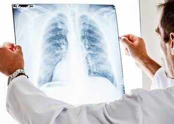 Hedefe yönelik tedaviler ile akciğer kanseri hastalarının umudu arttı