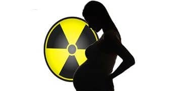 Gebelik döneminde röntgene dikkat! Radyasyon gelişim geriliğine yol açar