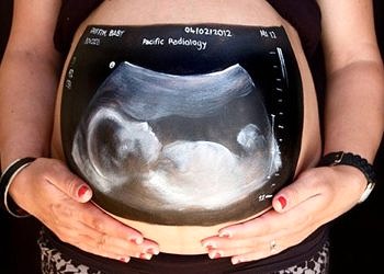 Gebelik döneminde röntgene dikkat! Radyasyon gelişim geriliğine yol açar