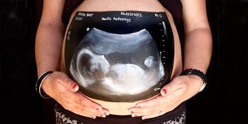 Gebelik döneminde röntgene dikkat! Radyasyon gelişim geriliğine yol açar