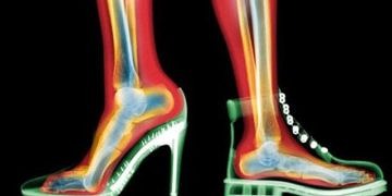 Topuklu ayakkabı ciddi sağlık sorununa neden olabilir