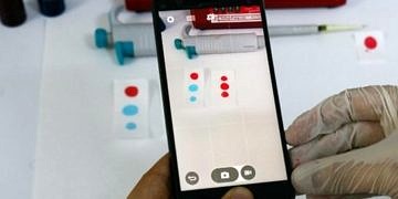 Akıllı telefonlar ile kan tahlili yapmak artık mümkün!