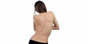 Çocukluk çağında skolyozu tespit etmenin 8 pratik yöntemi