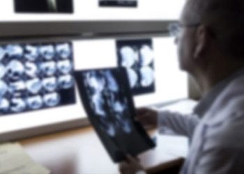 Otizm, belirtileri ortaya çıkmadan çok önce MR ile teşhis edilebilir