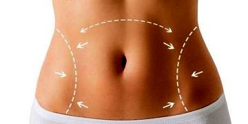 Sezaryenle aynı ayna karın germe yapılır mı?