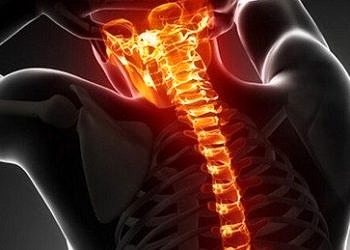 Geçmeyen sırt ağrıları omurilik tümörü belirtisi olabilir