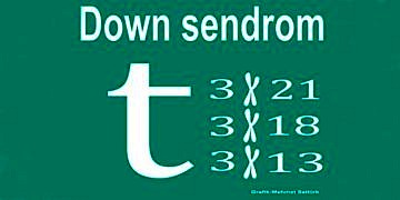 Kromozomal hastalıklar (Trizomi 21-18-13) ve Down sendromu, tanı ve tedavisi
