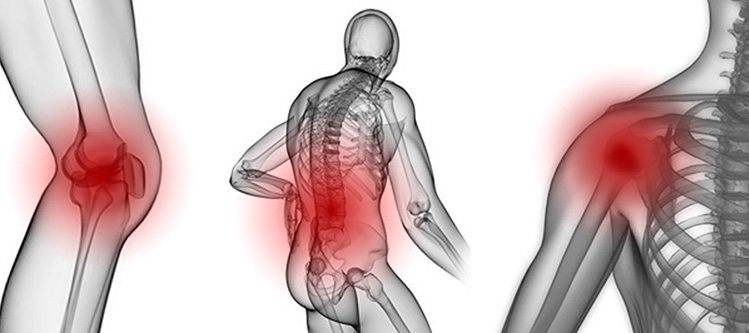 Etanercept Romatoid Artrit Tedavisinde Y ksek Klinik Remisyon Sa l yor