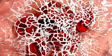 Yakın gelecekte hemofilide gen tedavisi mümkün olabilir