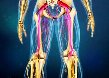 Siyatik nedir? Kimlerde görülür? Siyatiğin nedenleri ve belirtileri
