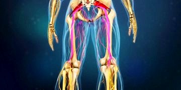 Siyatik nedir? Kimlerde görülür? Siyatiğin nedenleri ve belirtileri