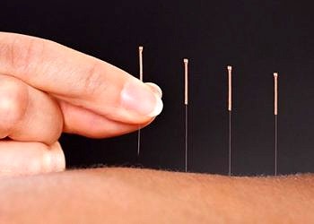 Akupunktur ile zayıflamak mümkün mü? Akupunkturun diyete etkisi