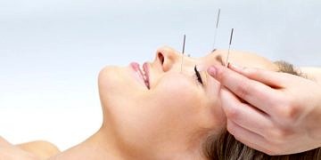Akupunktur ile zayıflamak mümkün mü? Akupunkturun diyete etkisi