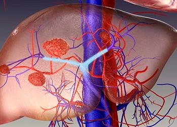 Karaciğer kanseri hepatosellüler karsinom tedavisinde yeni tedavi seçeneği
