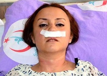 Şikayetini geri almayan doktora saldırıp burnunu kırdılar