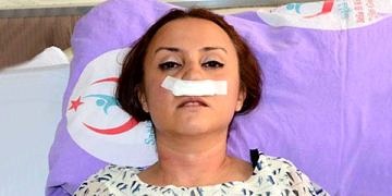 Şikayetini geri almayan doktora saldırıp burnunu kırdılar