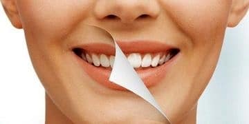 Diş estetiğinde devrim etkisi yaratan zirkonyum ile 1 haftada mükemmel gülüş!