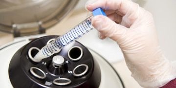 Dr. Seval Taşdemir: Üç ebeveynli bebek organ nakli gibi düşünülmeli