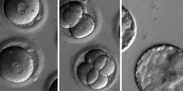 Bilim dünyasında bir ilk: Kalp hastalığına ‘genetik tamir’ tedavisi uygulandı