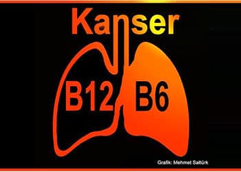 B6 ve B12 vitaminleri akciğer kanseri riskini yükseltiyor
