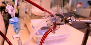 Canlı böbrek hücreleri ve mikroçiplerle yapay böbrek geliştirildi