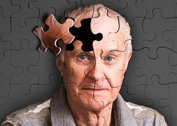 Erken teşhis ve etkili tedavi ile Alzhmeimer’dan kurtulmak mümkün