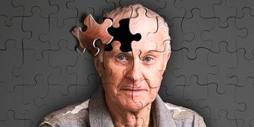 Erken teşhis ve etkili tedavi ile Alzhmeimer’dan kurtulmak mümkün