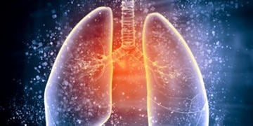 Ölümcül olabilen akciğer sertleşmesinin en önemli belirtisi kuru öksürük