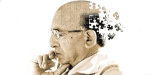 Alzheimer ilerleyici bir yaşlılık hastalığıdır