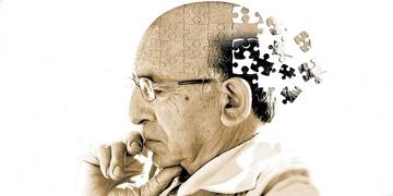 Alzheimer