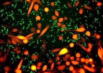 Kanser hücrelerini ilaçlardan koruyan ve tedaviyi engelleyen bakteriler keşfedildi