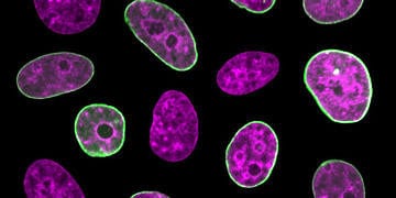 Yeni keşfedilen “hücre iç saati” ile hastalıklar daha kolay anlaşılabilecek