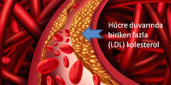 kolesterol nedir neden yukselir tedavisi ve iyi gelen yiyecekler