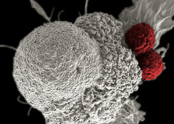 Kanser tedavisinde gen modifikasyonu, FDA’nın onayladığı ilk genetik terapi oldu