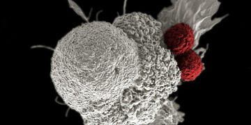 Kanser tedavisinde gen modifikasyonu, FDA’nın onayladığı ilk genetik terapi oldu