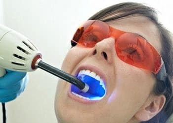 Diş tedavisinde lazer kullanımı riskli mi?