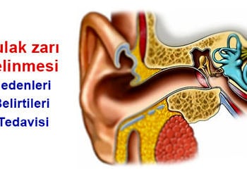 Kulak zarı delinmesi neden olur? Zar yırtılmasının belirtileri ve tedavisi