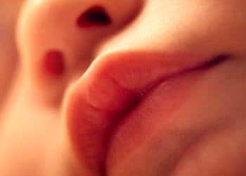 Yarık dudak-damak sorunu kader değil! Etkili şekilde tedavi edilebiliyor