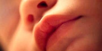 Yarık dudak-damak sorunu kader değil! Etkili şekilde tedavi edilebiliyor