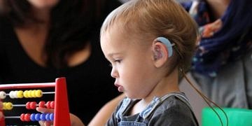 Biyonik kulak tedavisi işitme engelli olan bebeklerde mucize yaratıyor