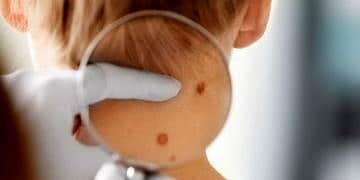 Cildimizin 5 önemli sinyali! Ciddi hastalıkların ilk belirtisi olabilir