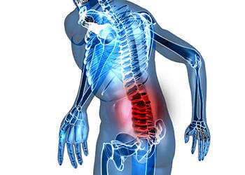 Bel fıtığı neden olur? Belirtileri, tedavi seçenekleri ve ameliyatı