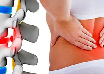 Bel fıtığı neden olur? Belirtileri, tedavi seçenekleri ve ameliyatı