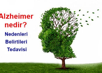 Alzheimer nedir? Nedenleri, belirtileri, tedavisi ve korunma