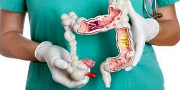 Kolon kanserlerine yol açan 9 önemli nedene dikkat ederek korunabilirsiniz!