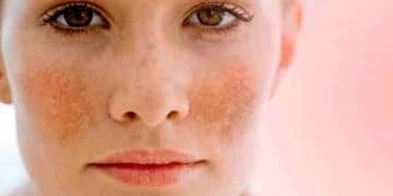 “Gebelik Maskesi” hamilelerin yüzde 75’inde görülüyor